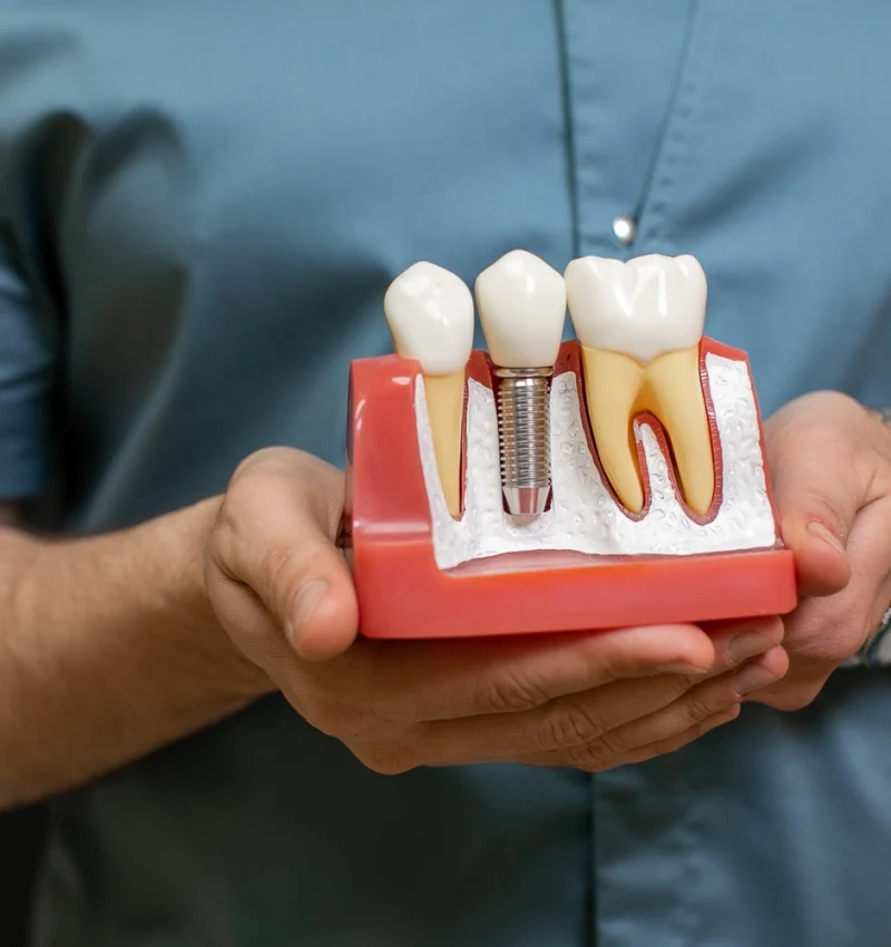 closeup-male-dentist-doctor-hands-with-dental-implant-model-as-teaching-aid-ezgif.com-optiwebp